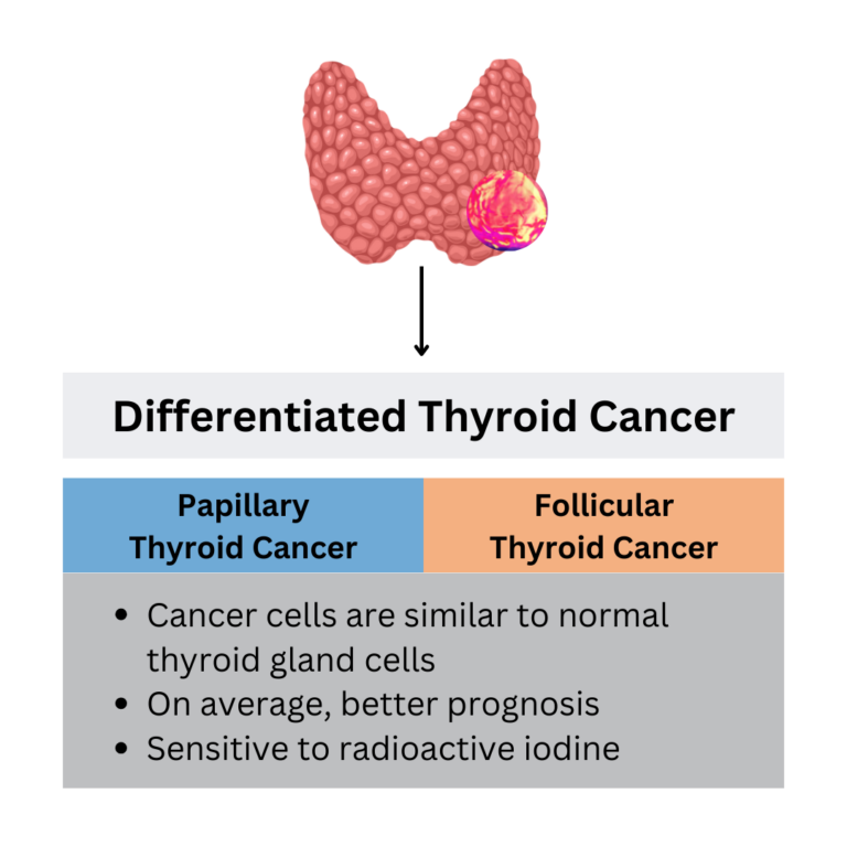 What Does it Mean to have “Differentiated Thyroid Cancer”? – Qualisure