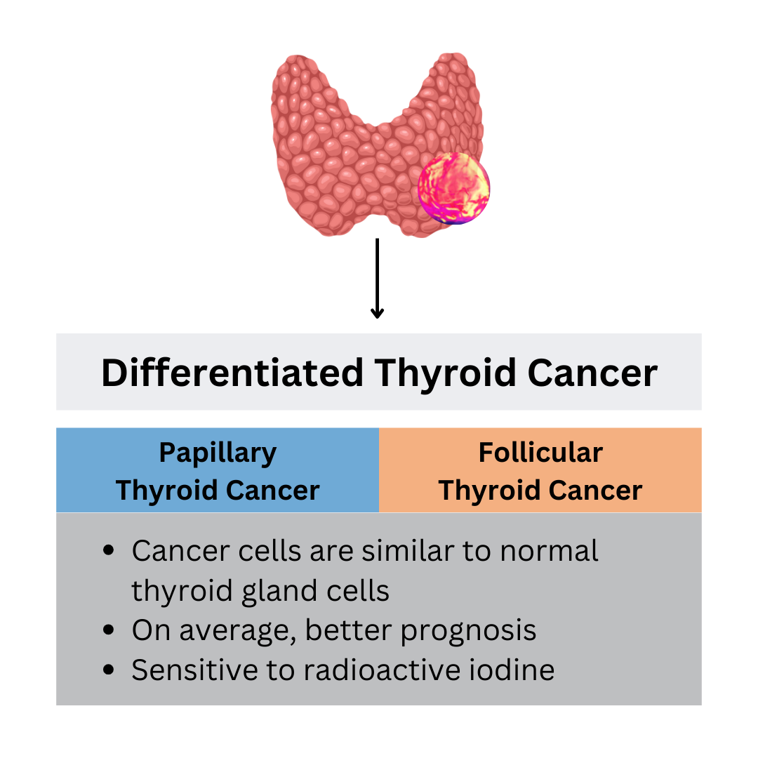 What does it mean to have Differentiated Thyroid Cancer? Two main types include papillary thyroid carcinoma and follicular thyroid carcinoma.