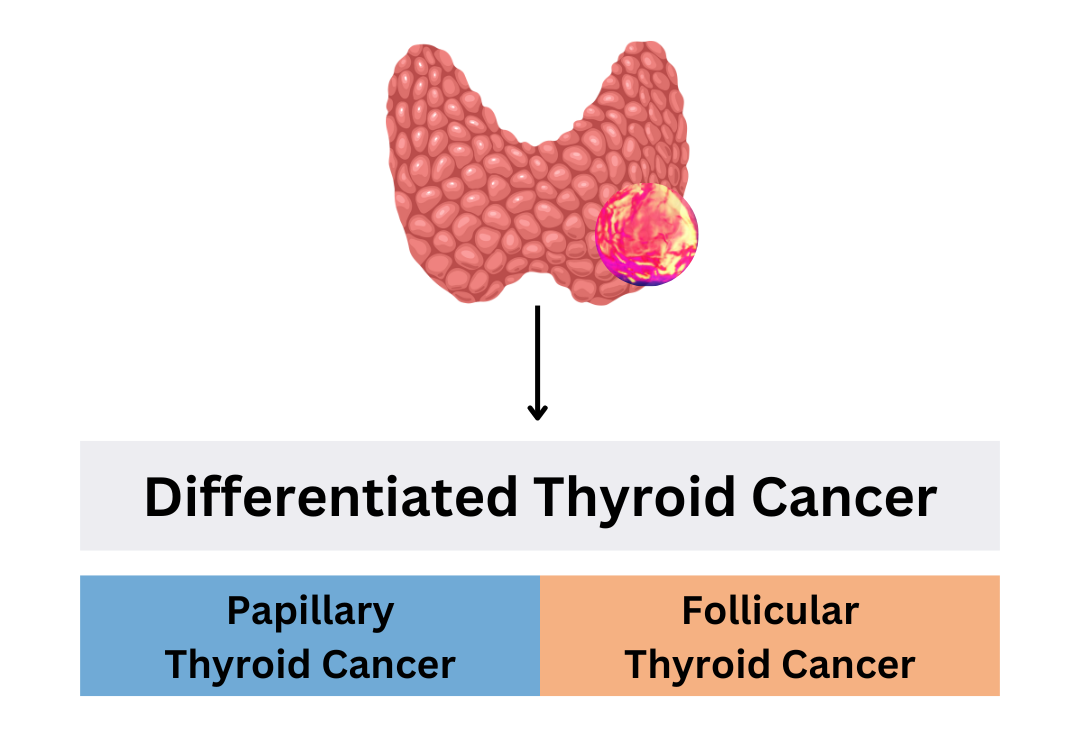 Read more about the article What Does it Mean to have “Differentiated Thyroid Cancer”?